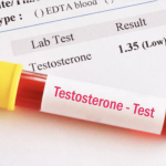 TRT Can Relieve Andropause and Low Testosterone Symptoms